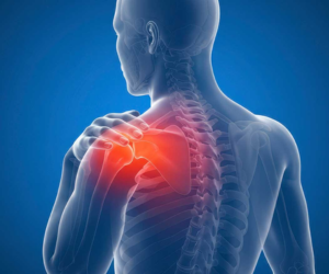 Frozen Shoulder Treatment in Mumbai by Dr. Chintan Desai