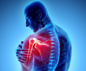 Shoulder Arthritis treatment in Mumbai by Dr. Chintan Desai