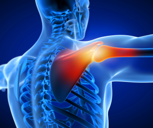 Shoulder Dislocation treatment in mumbai by Dr. Chintan Desai